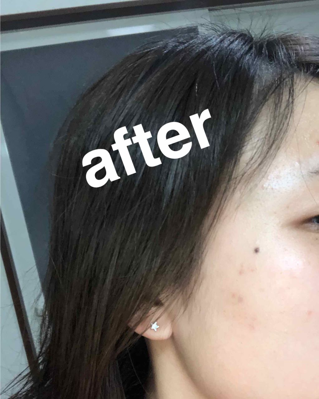 バイオイル/バイオイル/フェイスオイルを使ったクチコミ（3枚目）