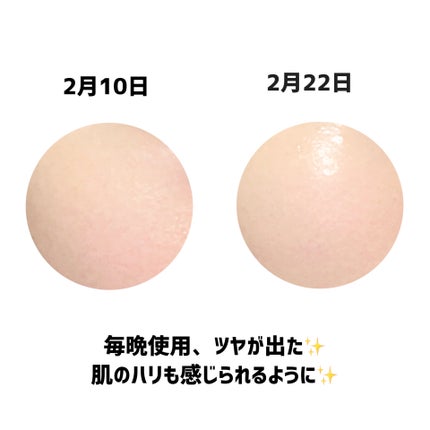 ビタペアC ビタレチ美容液/ネイチャーリパブリック/美容液を使ったクチコミ(3枚目)