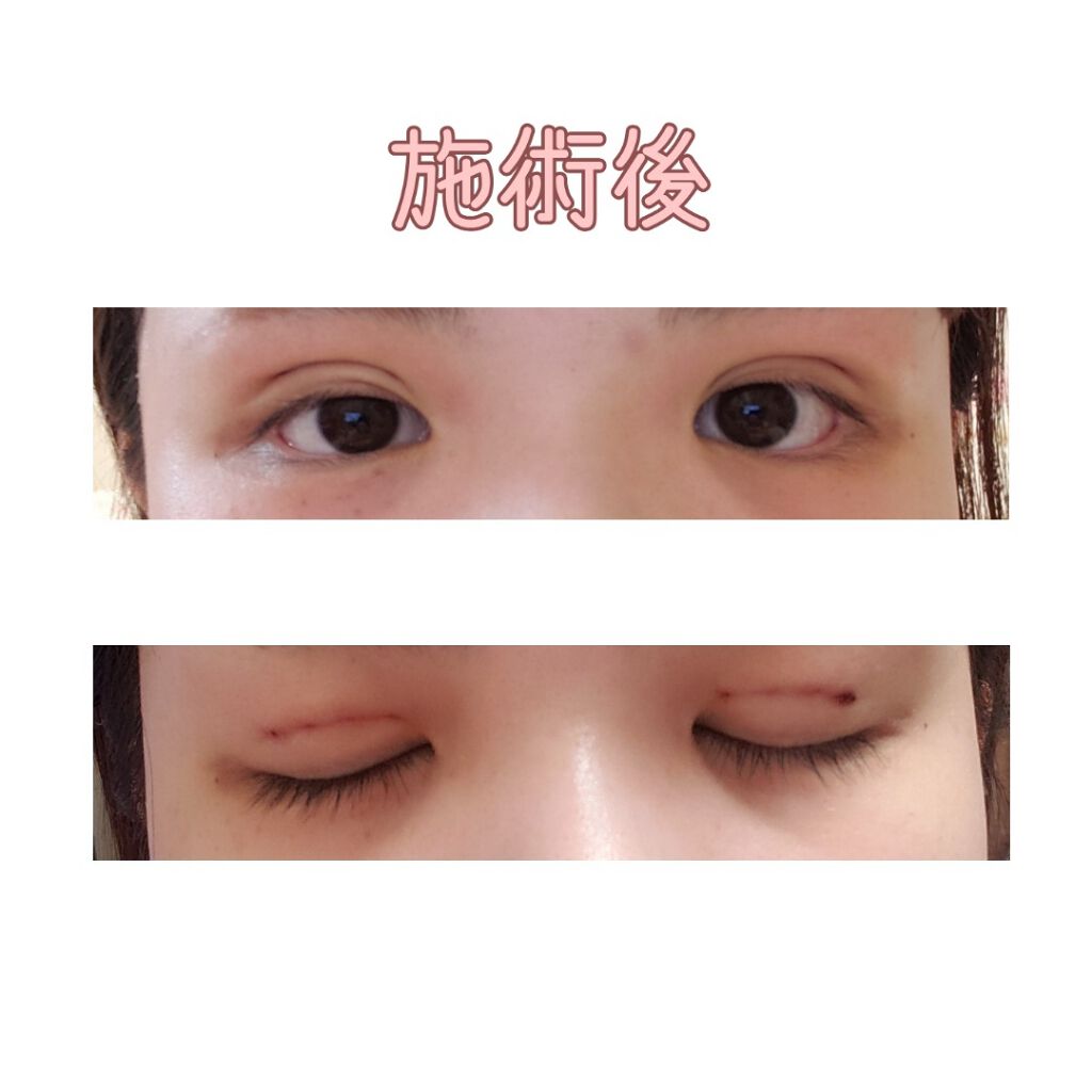 ððâââðžððð§ž on LIPS ããã®åºŠãäºéæŽåœ¢ãããŸãããå·è·¡ãèŠæãªæ¹ã¯èŠãªãæ¹ããããã..ãïŒ2æç®ïŒ