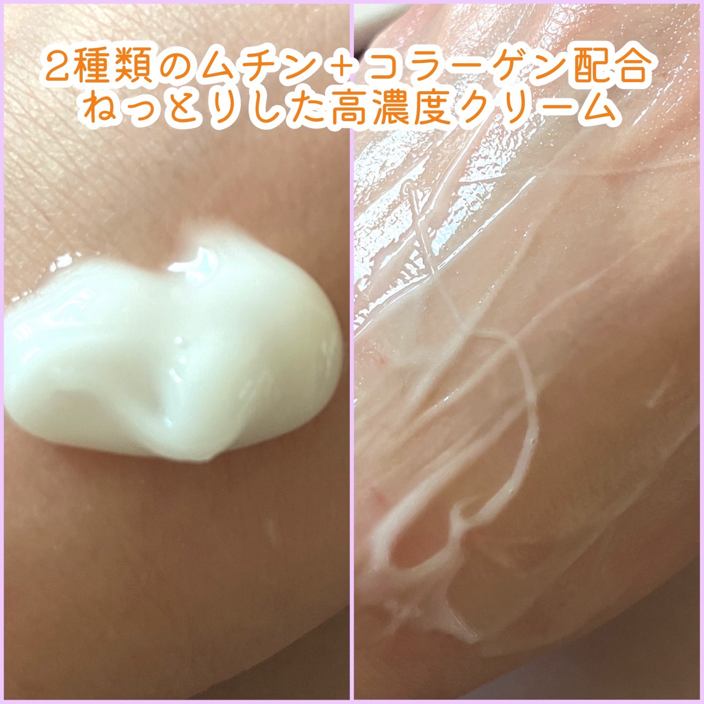 ディセラクリーム+ローラーset/リリーイブ/レッグ・フットケアを使ったクチコミ(3枚目)