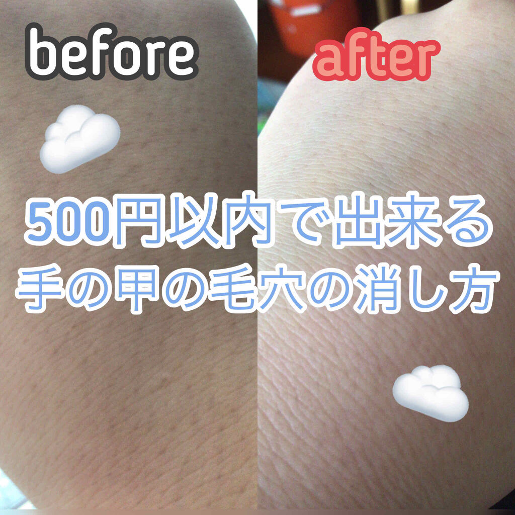 ベビーオイル ナチュラル/DAISO/ボディオイルを使ったクチコミ（1枚目）