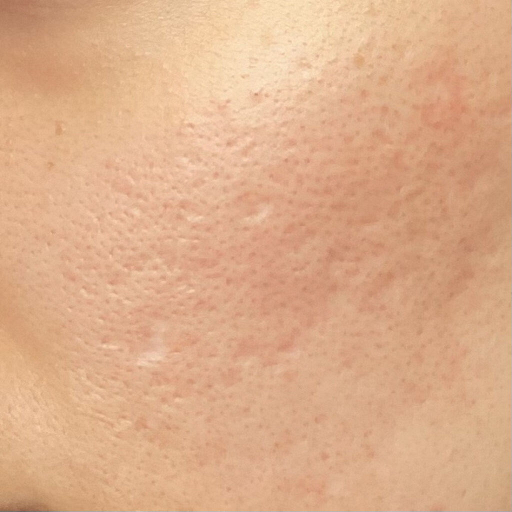 ピンクティーツリーカバークッション/APLIN/クッションファンデーションを使ったクチコミ（2枚目）