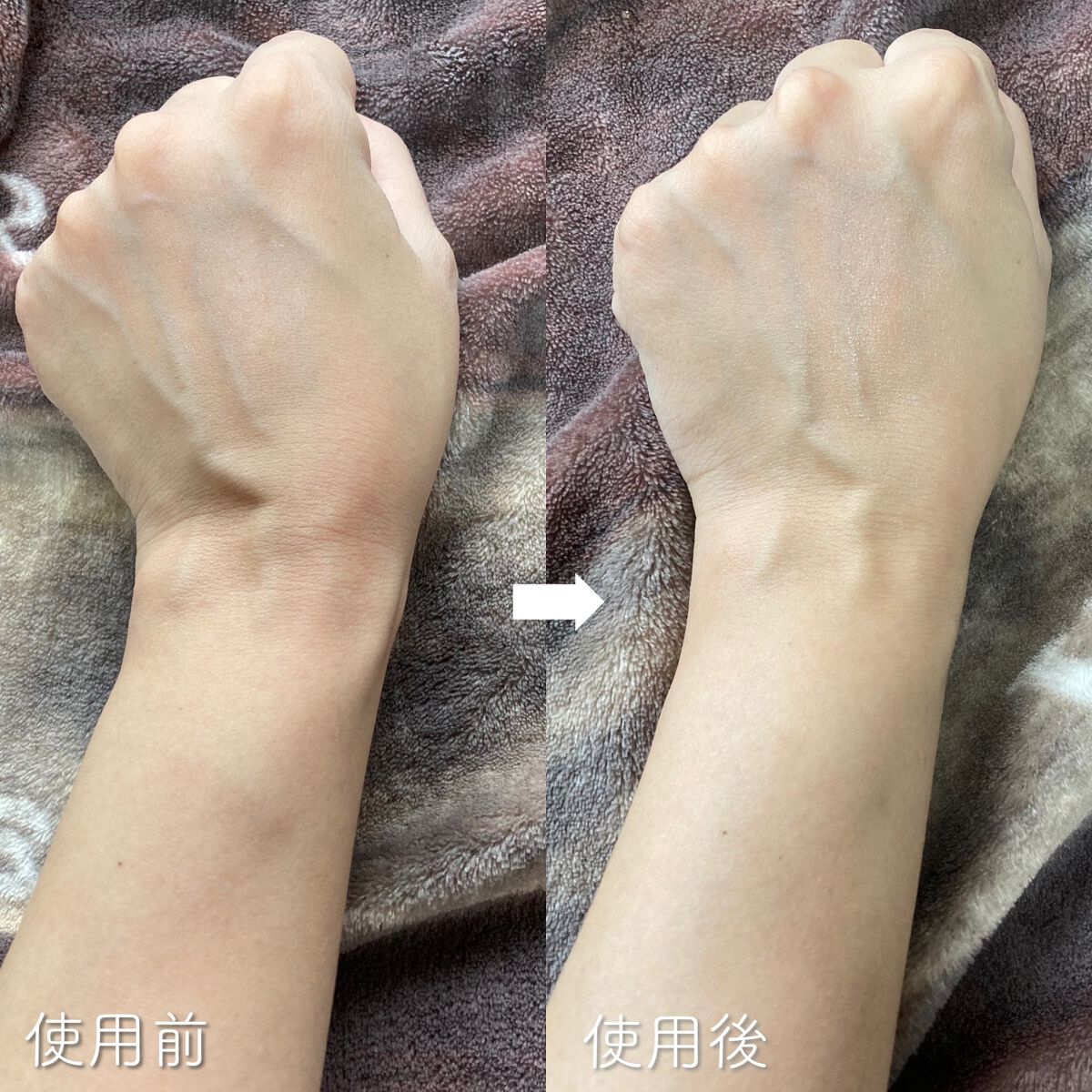 AHA·BHA·PHA 30デイズミラクルアクネボディクレンザー/SOME BY MI/ボディソープを使ったクチコミ(4枚目)