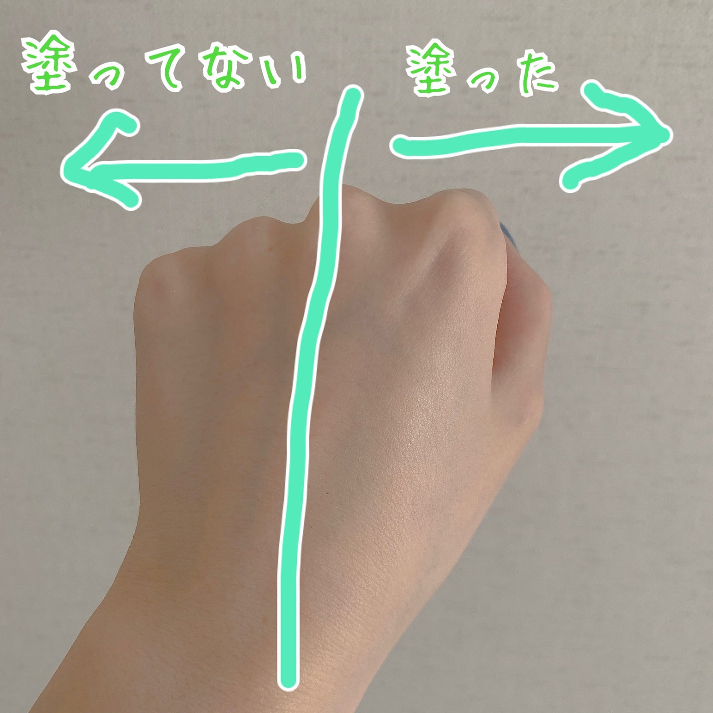 シカレチA クリーム0.05/VT/フェイスクリームを使ったクチコミ(8枚目)