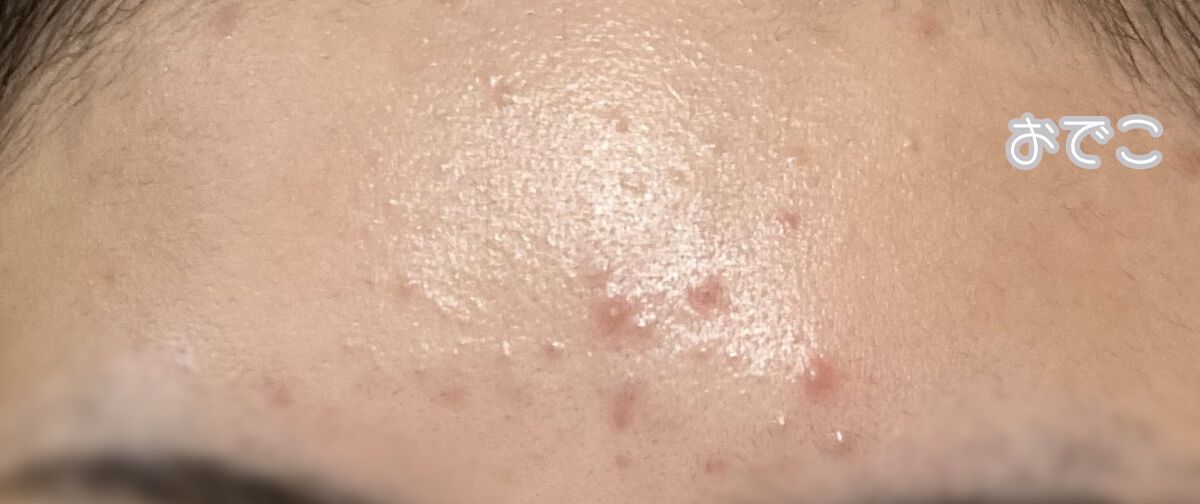 薬用しみ対策 美白化粧水 しっとりタイプ/メラノCC/化粧水を使ったクチコミ（2枚目）