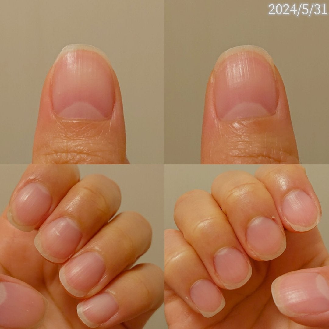 ネイルベッドオイル/アンドネイル/ネイルオイル・トリートメントを使ったクチコミ(2枚目)
