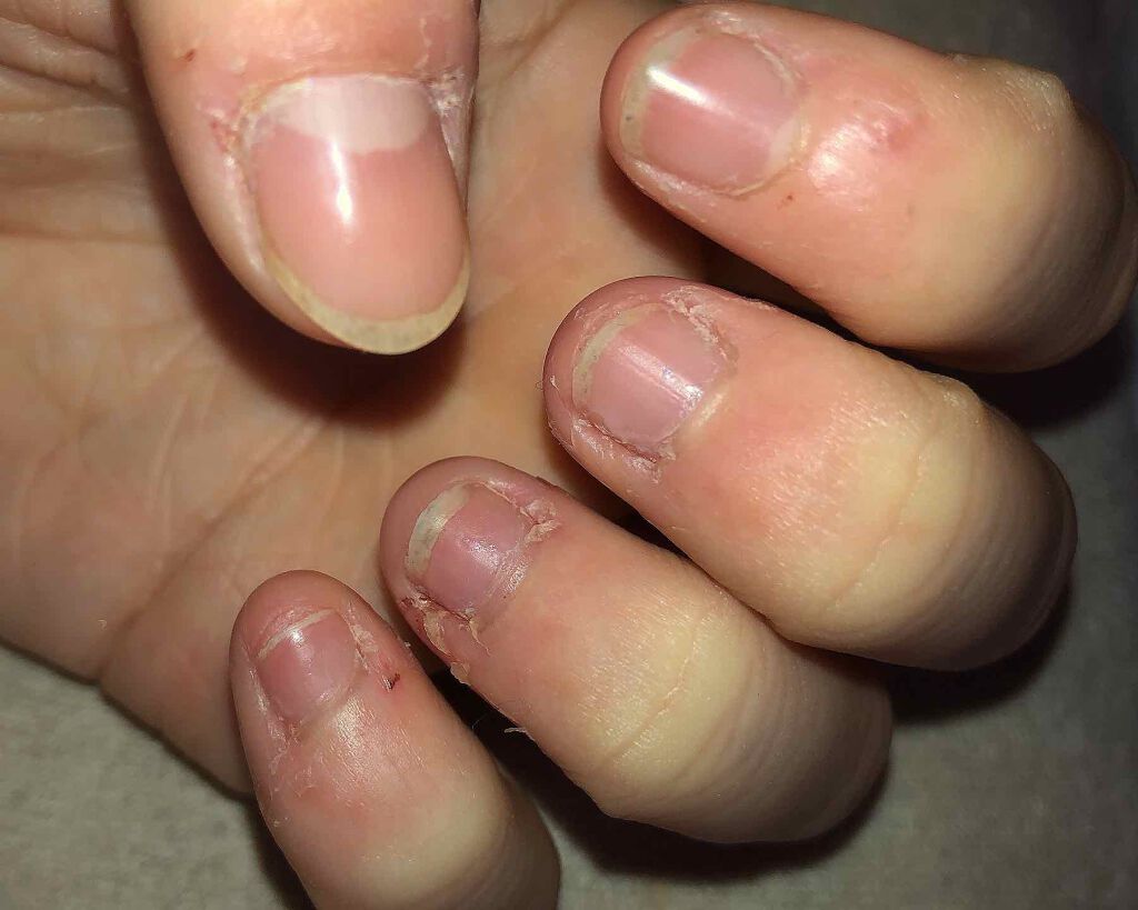 カラフルネイルズ TO(トリートメントオイル)/キャンメイク/ネイルオイル・トリートメントを使ったクチコミ（2枚目）