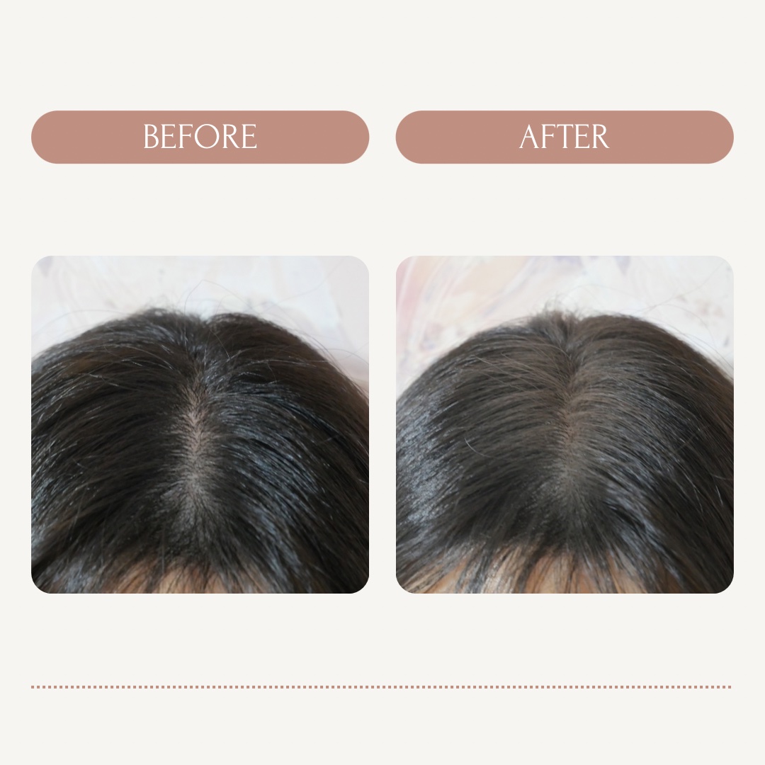 ボリュームアップスプレー/ARUN+ 3D STYLE/ヘアスプレーを使ったクチコミ（2枚目）