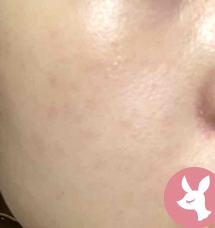 アルガンオイル/エトヴォス/フェイスオイルを使ったクチコミ(4枚目)