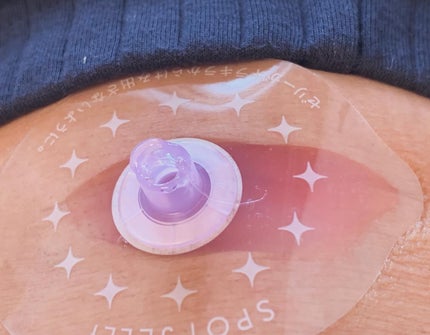 SPOT JELLY(スポッ!とジェリー)へそごまパック/花王/その他スキンケアを使ったクチコミ(6枚目)