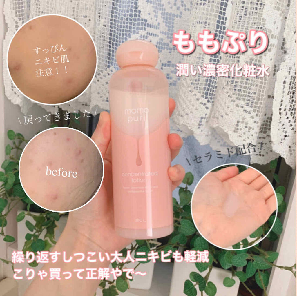 潤い濃密化粧水/ももぷり/化粧水を使ったクチコミ（1枚目）