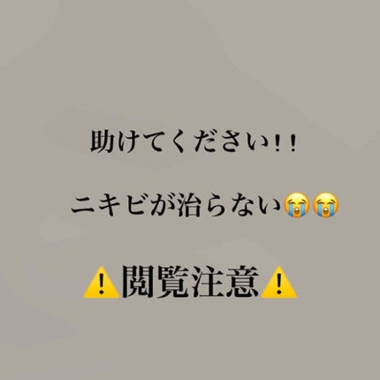 ゼビアックス(医薬品)/マルホ株式会社/その他を使ったクチコミ(1枚目)