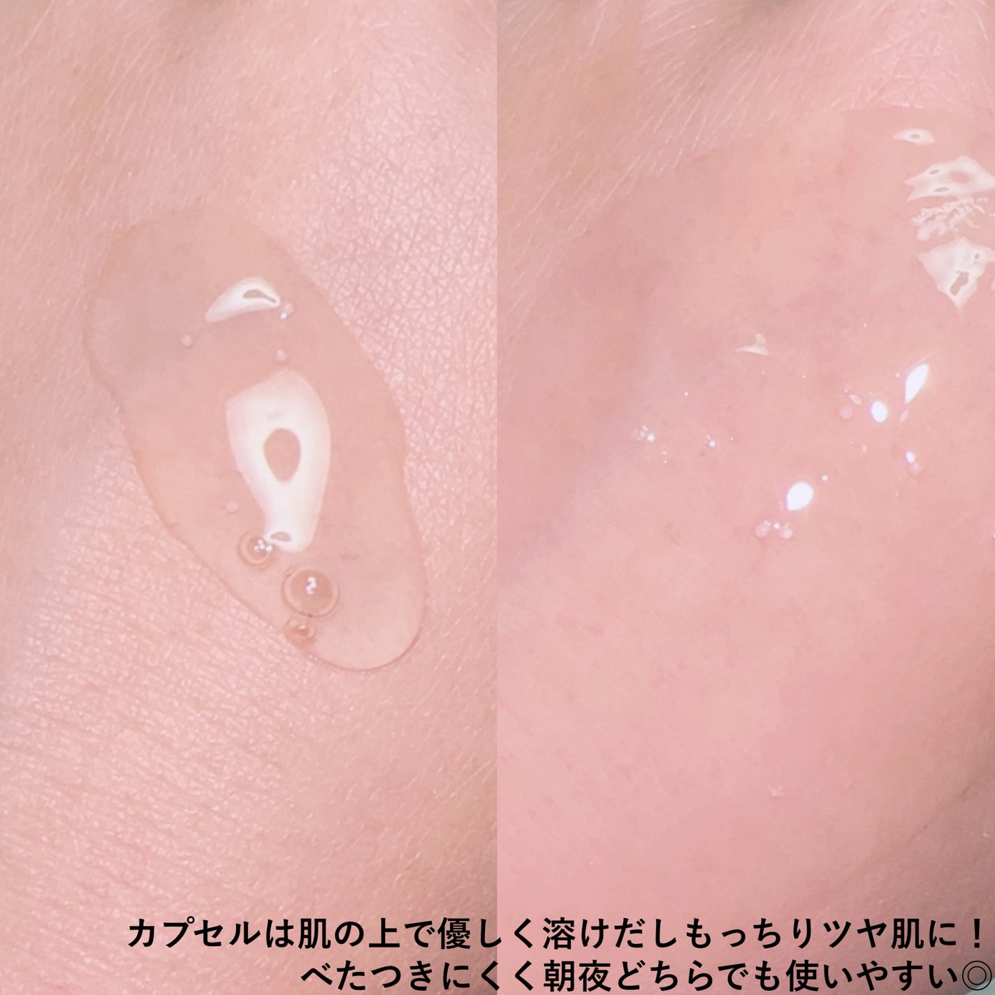 トーンブライトニング カプセルアンプル/SKIN1004/美容液を使ったクチコミ(4枚目)