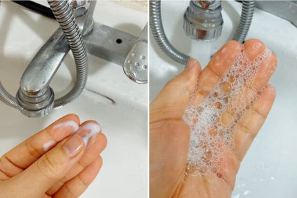 ノーロス スケーリング セラピー シャンプー/FEDORA AESTHETIC/市販シャンプーを使ったクチコミ(1枚目)