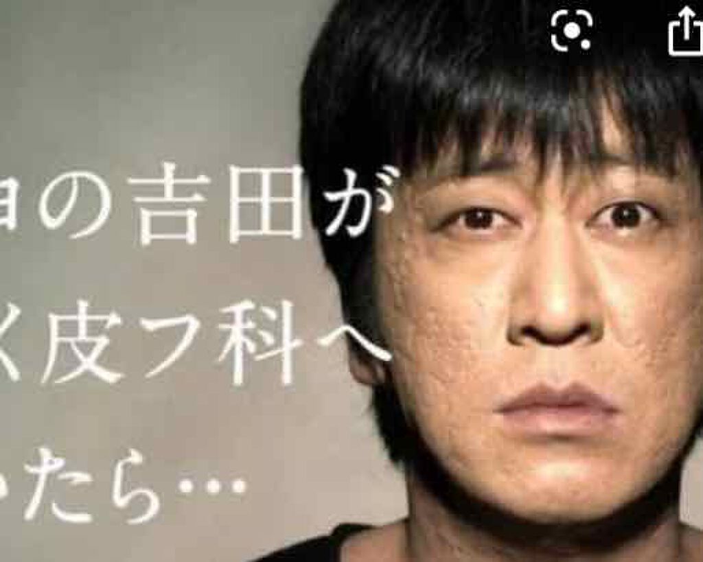 みーみー on LIPS 「春休みで夜更かし夜更かし♪翌日顔を見ると、、((^ω^≡^ω<..」(2枚目)