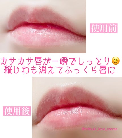 ãã¬ãã¢ã ã¡ã«ãã£ãªãã/ã¡ã³ãœã¬ãŒã¿ã /ãªããã¯ãªãŒã ã䜿ã£ãã¯ãã³ãïŒ5æç®ïŒ