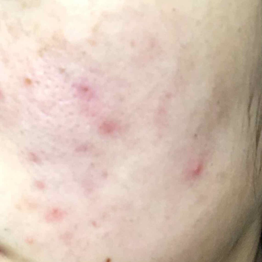 ハトムギ化粧水(ナチュリエ スキンコンディショナー R )/ナチュリエ/化粧水を使ったクチコミ（2枚目）