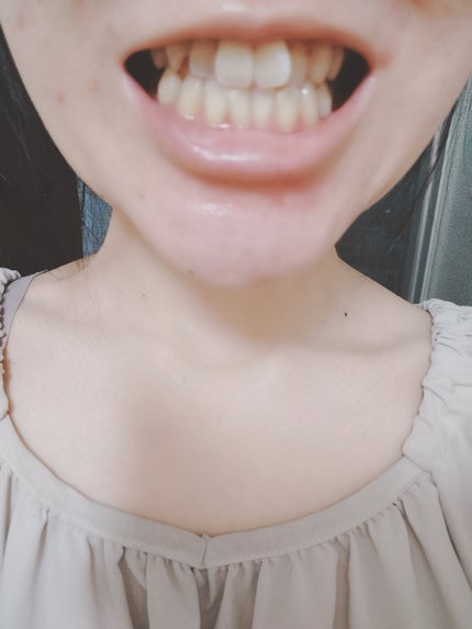 ホワイトニングパウダー ミント/Dr.Oral/歯磨き粉を使ったクチコミ(1枚目)