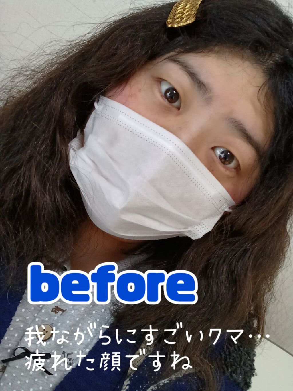 コールドクリーム (ハニーマイルド)/ソフティモ/クレンジングクリームを使ったクチコミ（3枚目）