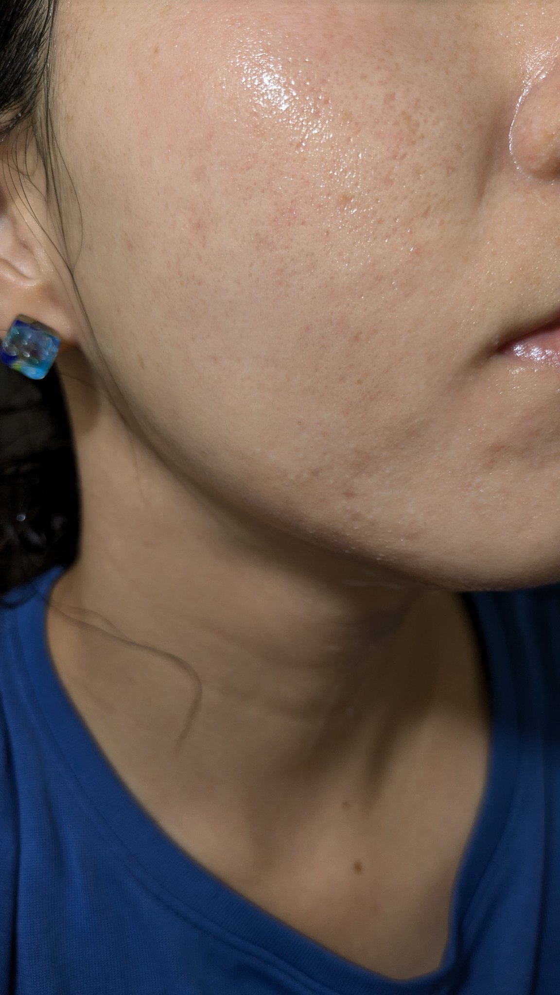 A2+NAG2ソリューション/The Ordinary/美容液を使ったクチコミ（1枚目）