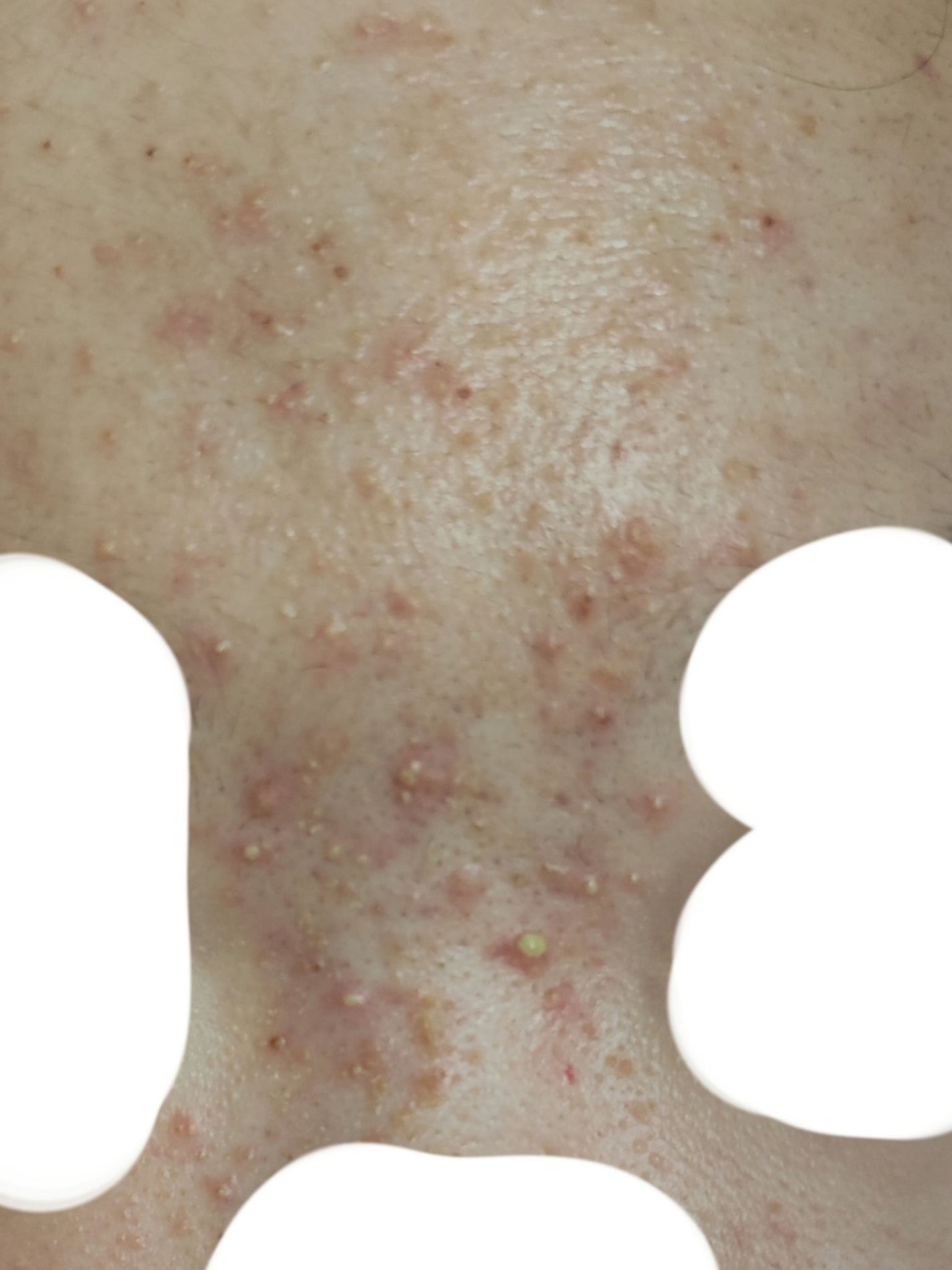 日 記 帳 on LIPS 「つらい!でもこれがデフォルトだからつらいというよりは諦め寄りで..」(2枚目)