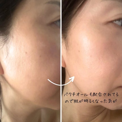 えむEMU美容編集部 on LIPS 「EMU美容編集部@otonajoshi_emuでは気分が上がる..」(5枚目)