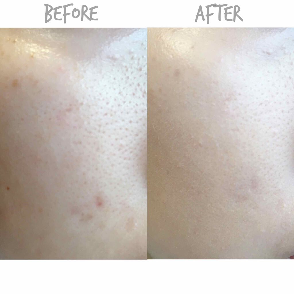 【旧】ディオールスキン フォーエヴァー フルイド/Dior/リキッドファンデーションを使ったクチコミ（3枚目）