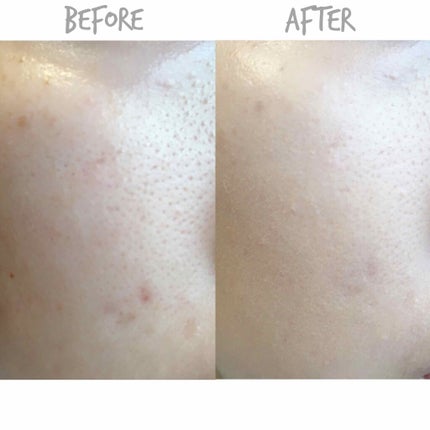 Dior 【旧】ディオールスキン フォーエヴァー フルイドのクチコミ「#使い切りコスメ
Dior
ディオールスキン フォーエバー フルイド
今のforever.....」(3枚目)