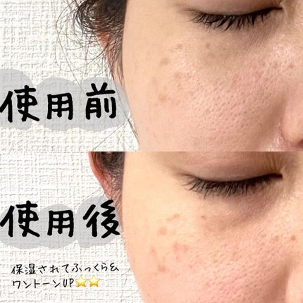 スパークリングパック/Urar /シートマスク・パックを使ったクチコミ(4枚目)