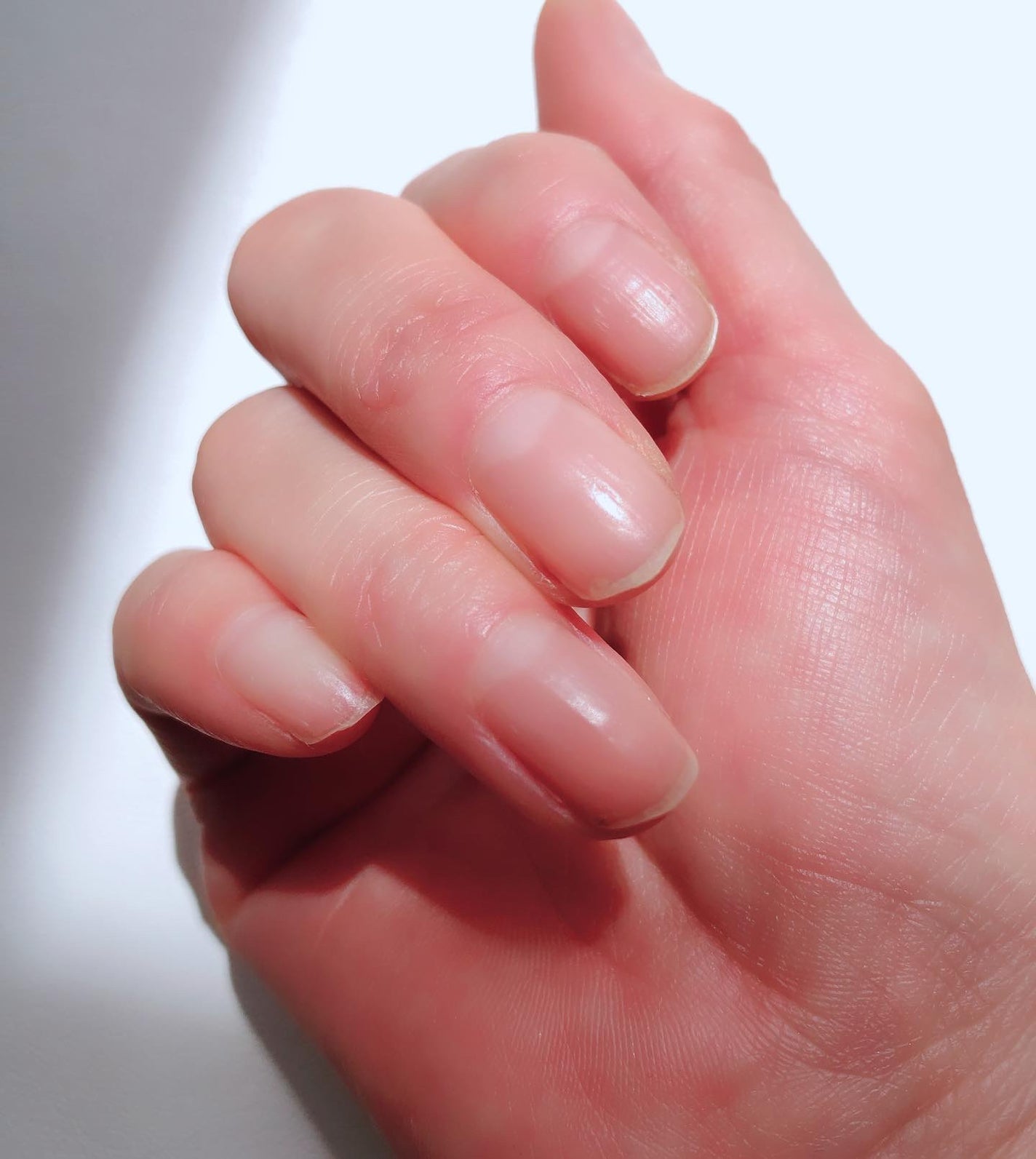 自爪コート/ネイリスト/オールインワンネイルを使ったクチコミ(3枚目)