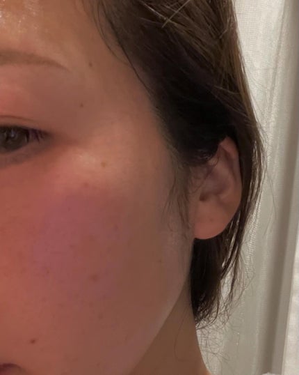 RTXイントゥメルティングコラーゲンフィルム/Dr.G/その他スキンケアを使ったクチコミ(5枚目)