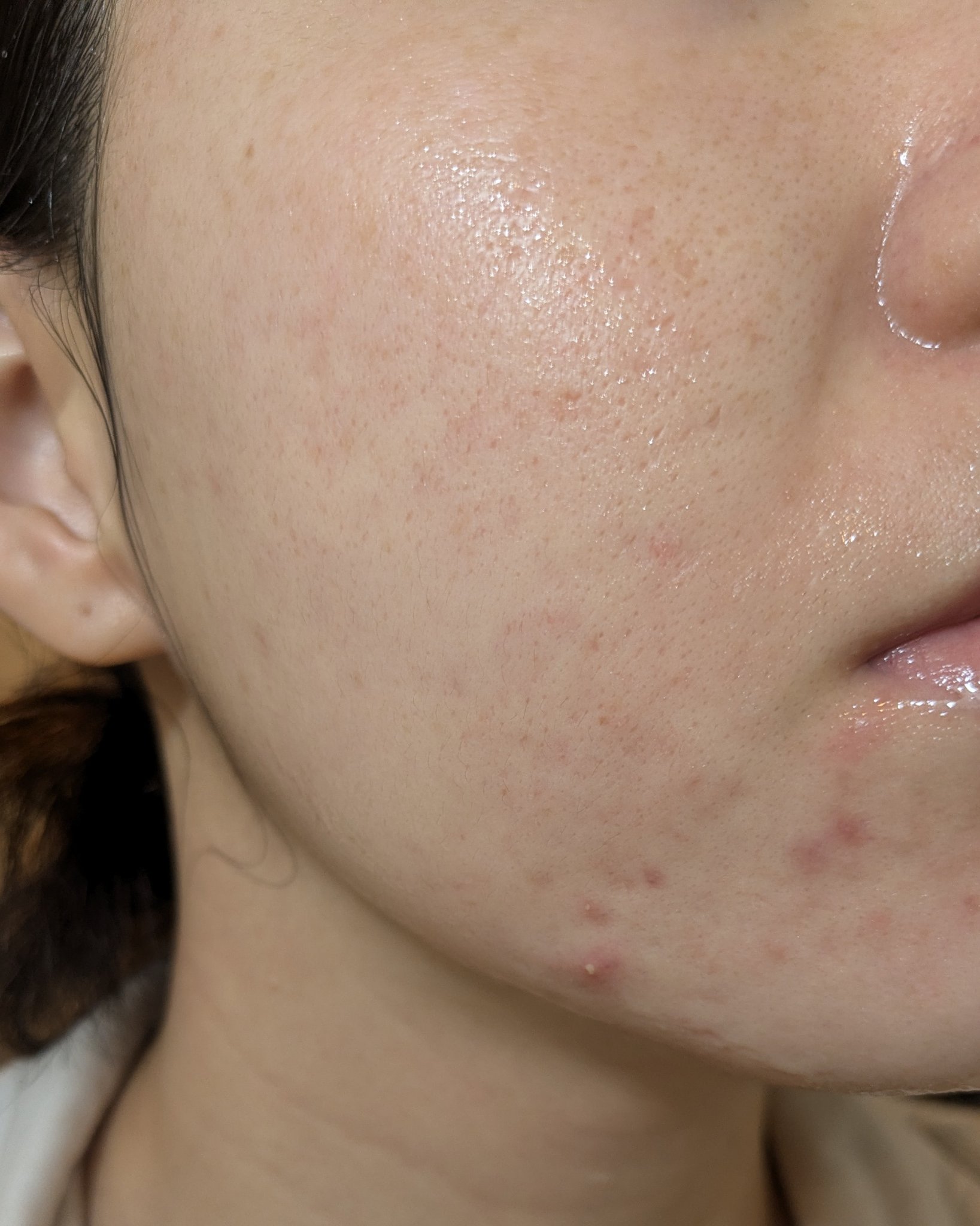 10/29の#汚肌工事録

😂