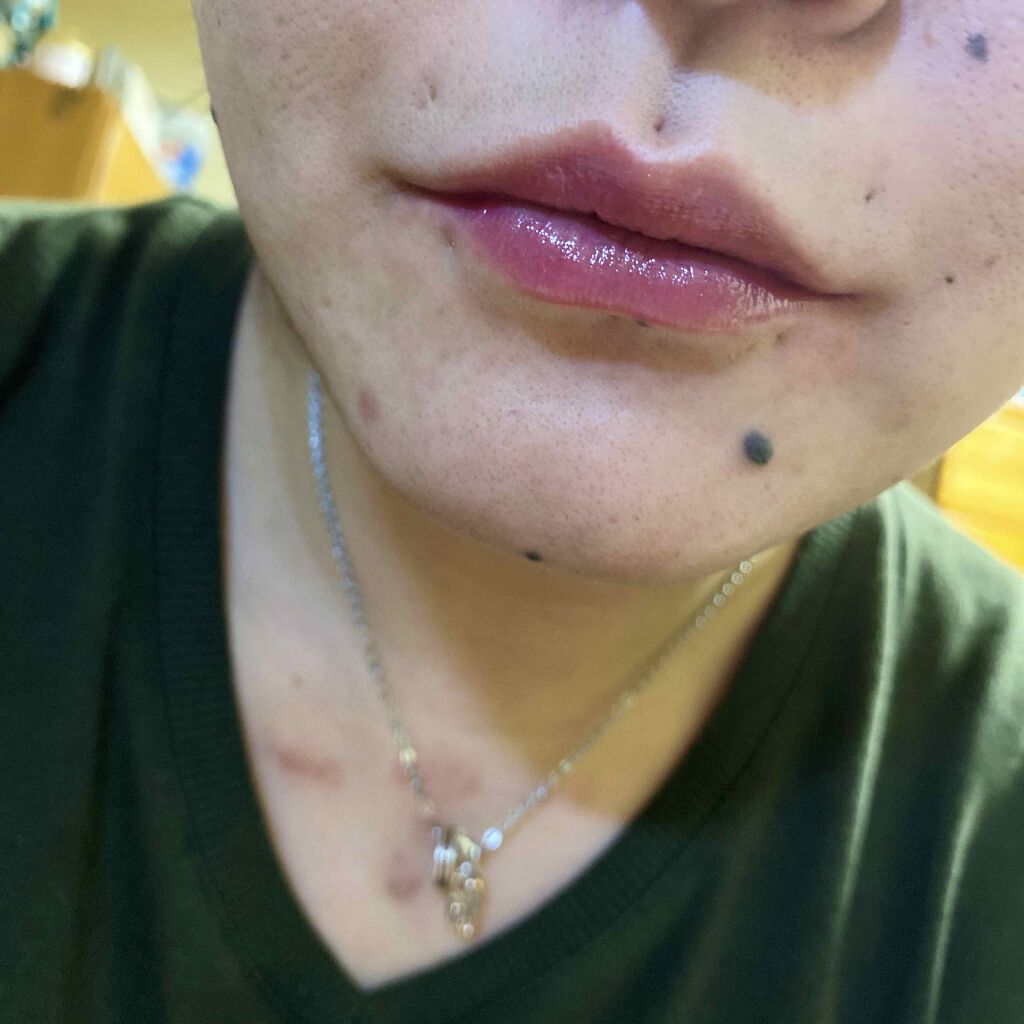 リッププランパー エクストラプラス/Borica/リップグロスを使ったクチコミ(4枚目)