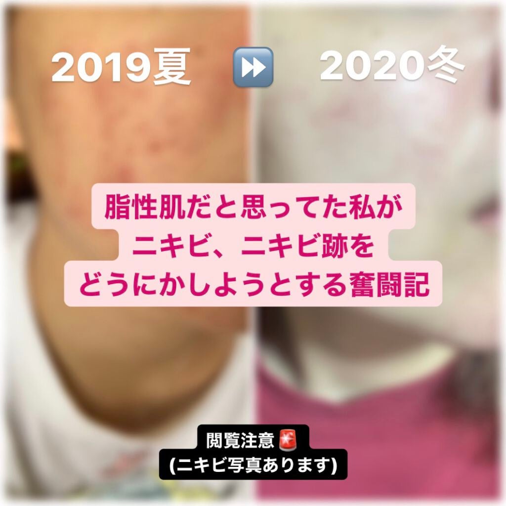 サンシビオ エイチツーオー D/ビオデルマ/クレンジングウォーターを使ったクチコミ(1枚目)