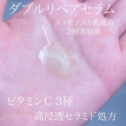 VC100エッセンスローション EX/ドクターシーラボⓇ/化粧水を使ったクチコミ(2枚目)