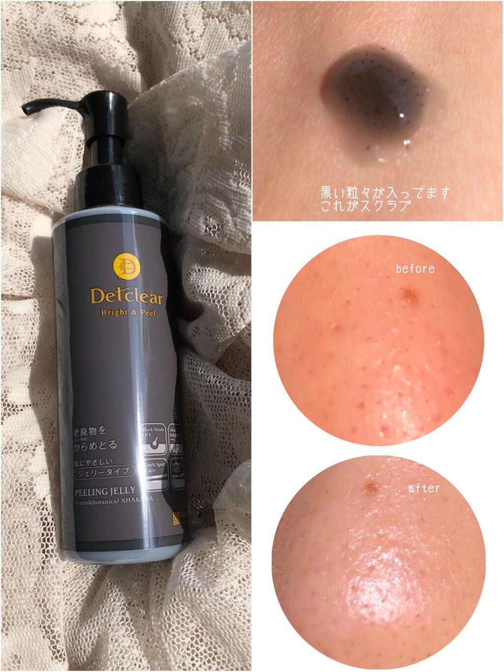 DETクリア ブライト&ピール ピーリングジェリー 炭/Detclear/ピーリングを使ったクチコミ(1枚目)