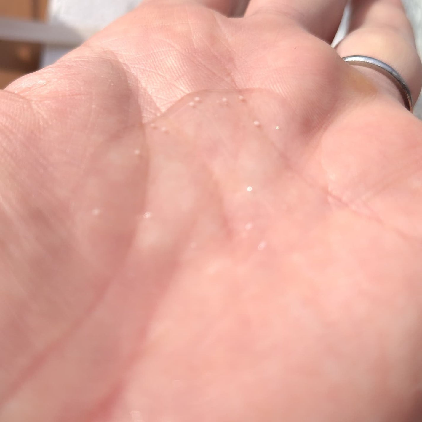 トーンブライトニング カプセルアンプル/SKIN1004/美容液を使ったクチコミ(4枚目)