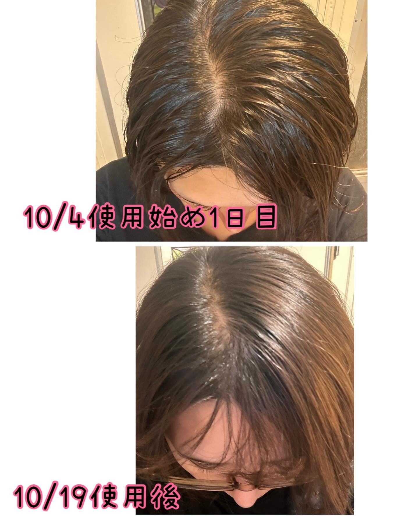 ナノグロウリッチ/iqumore/頭皮ローションを使ったクチコミ（2枚目）