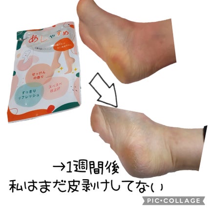 あしやすめ 足裏角質ケアパック/鎌倉ライフ/レッグ・フットケアを使ったクチコミ(4枚目)