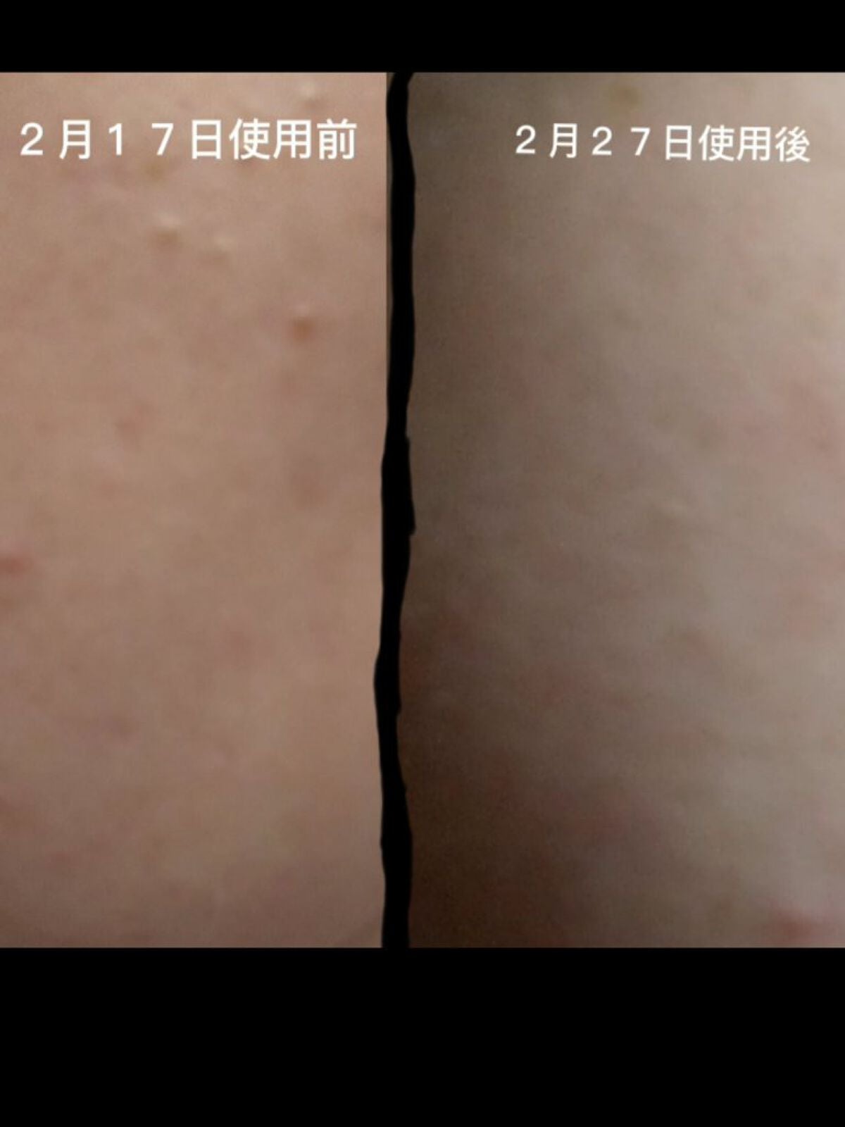 シカレチA エッセンス0.1/VT/美容液を使ったクチコミ(6枚目)