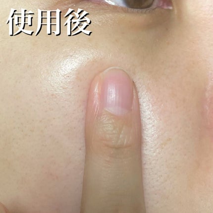 ドクタージャルト シェイキング ラバー シェイク&ショット/Dr.Jart+/シートマスク・パックを使ったクチコミ(8枚目)