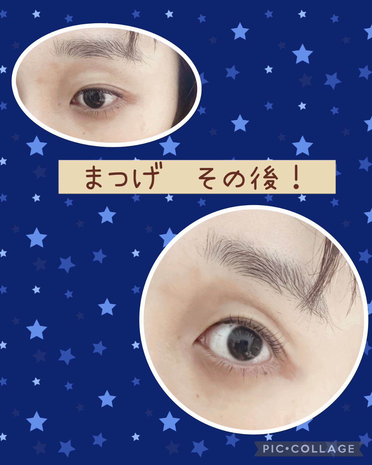 アヴァンセ ラッシュセラム EX(医薬部外品)/アヴァンセ/その他を使ったクチコミ（1枚目）