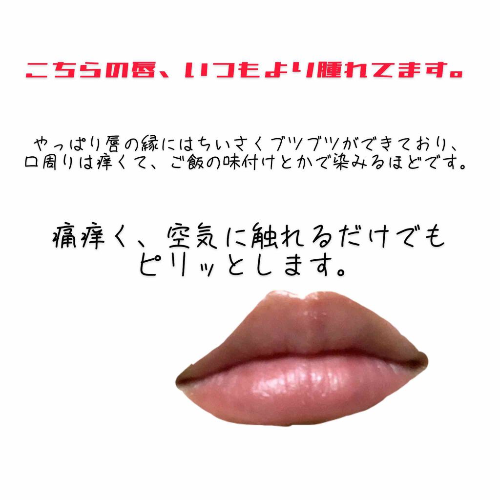 リップグロウ バーム/JILL STUART/リップバームを使ったクチコミ(2枚目)