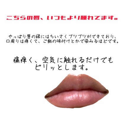 リップグロウ バーム/JILL STUART/リップバームを使ったクチコミ(2枚目)