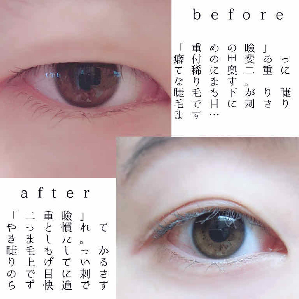 のびーるアイテープ（絆創膏タイプ、レギュラー）/DAISO/二重まぶた用アイテムを使ったクチコミ（2枚目）