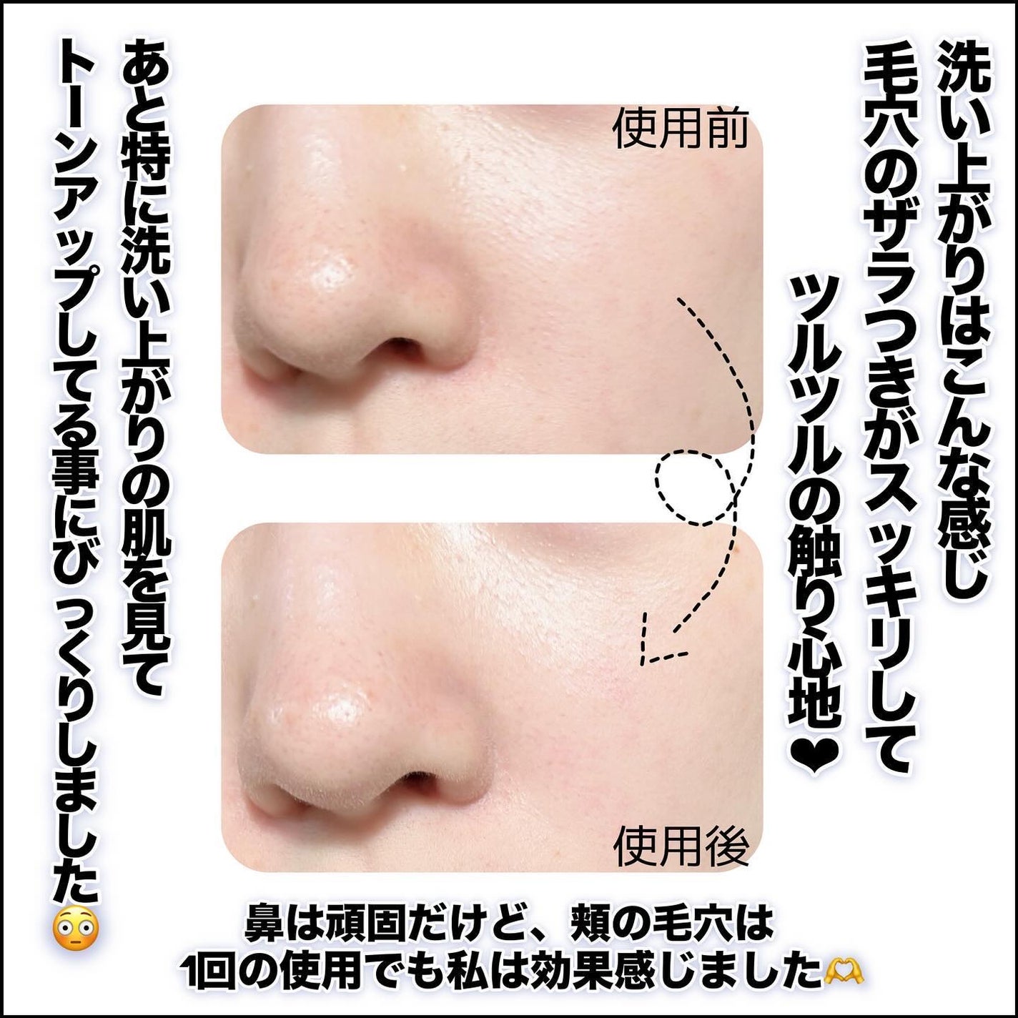 ゼロ毛穴クレイパック/MEDICUBE/洗い流すパック・マスクを使ったクチコミ(4枚目)