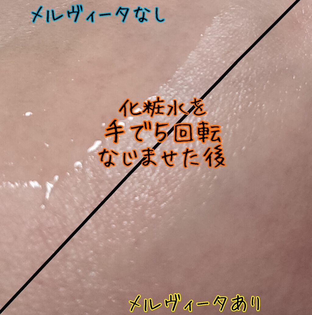 ビオオイル アルガンオイル/Melvita/フェイスオイルを使ったクチコミ(4枚目)