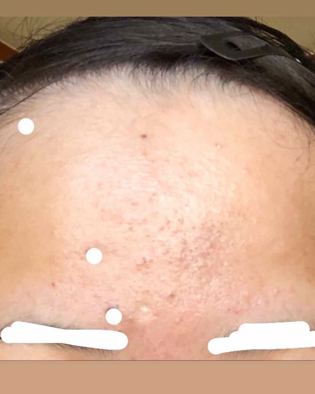 ドクタージャルト シカペア クリーム （第2世代）/Dr.Jart＋/フェイスクリームを使ったクチコミ（2枚目）