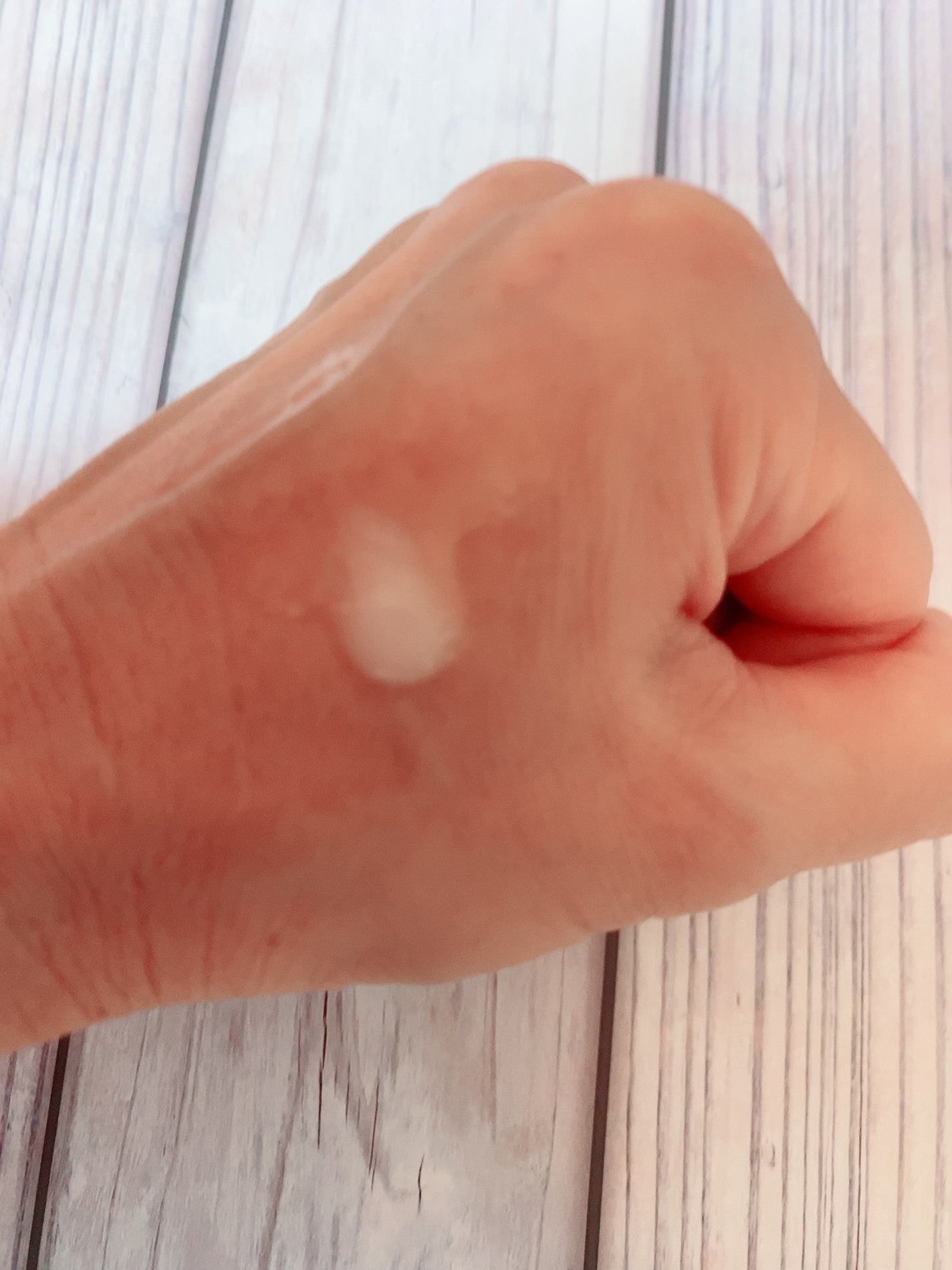 リードルショット300/VT/美容液を使ったクチコミ(4枚目)