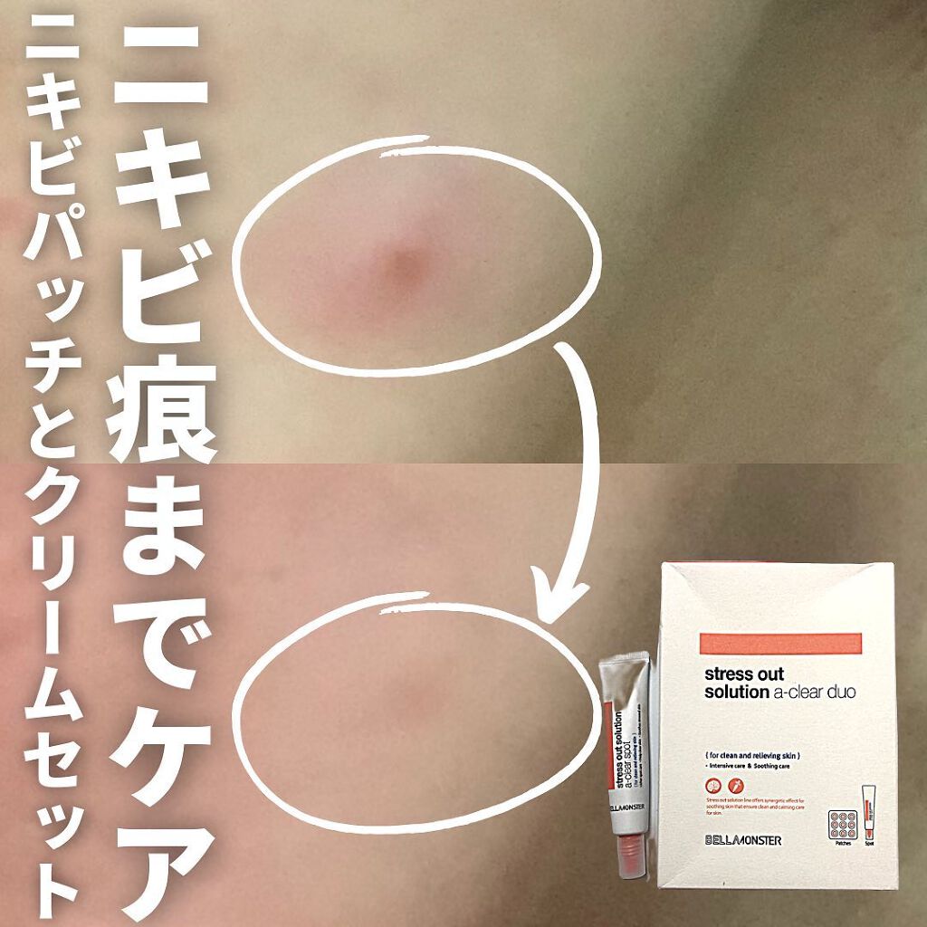 stress out solution a-clear duo/BELLAMONSTER/その他スキンケアを使ったクチコミ(1枚目)